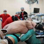 Hastaneye sedye ile gelen 310 kiloluk Aydınlı adam yürüyerek taburcu oldu 5 Hastaneye sedye ile gelen 310 kiloluk Aydınlı adam yürüyerek taburcu oldu
