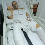 Doktorlar ‘yaşamaz’ dedi, eşinin desteği hayatta tuttu