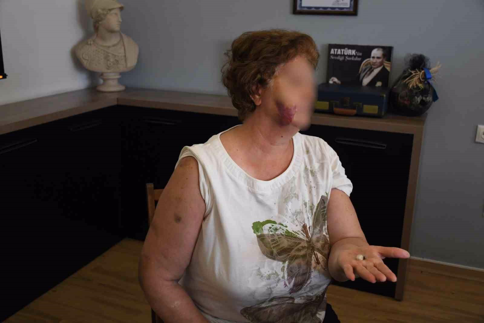 Kuşadası’nda ev kavgası kanlı bitti: Anne ve iki çocuğu bıçaklandı